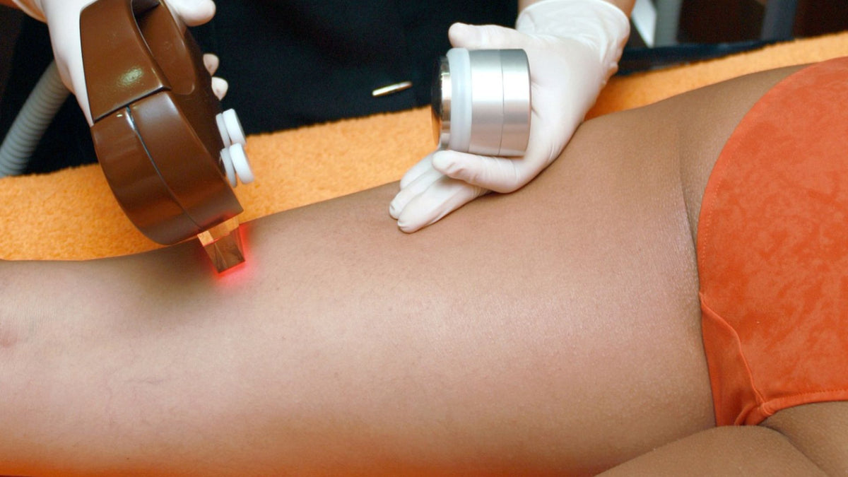 Pourquoi choisir l’épilateur à lumière pulsée ?